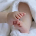 Pukkels baby